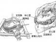 尊龙凯时心胸外科血管外科妙手解决心脏顽疾，获患者点赞