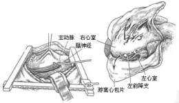 尊龙凯时心胸外科血管外科妙手解决心脏顽疾，获患者点赞